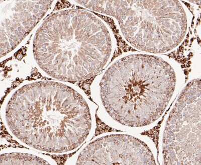 Immunohistochemistry-Paraffin: Dfna5 Antibody [NBP2-80426]