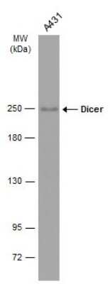 Western Blot: Dicer Antibody (GT1176) [NBP3-13572]