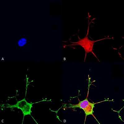 Immunocytochemistry/ Immunofluorescence: Dicer Antibody (S167-7) [NBP2-22415]