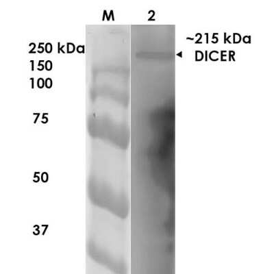 Western Blot: Dicer Antibody (S167-7) [NBP2-22415]