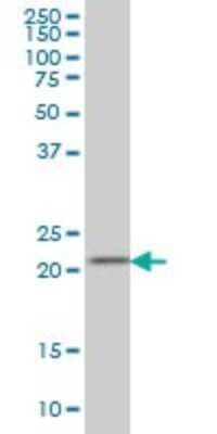 Western Blot: Dihydrofolate Reductase/DHFR Antibody (2B10) [H00001719-M01]