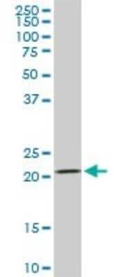 Western Blot: Dihydrofolate Reductase/DHFR Antibody (2B10) [H00001719-M01]