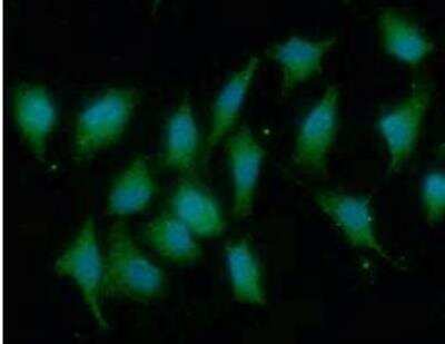 Immunocytochemistry/ Immunofluorescence: Dihydrofolate Reductase/DHFR Antibody (5B2) - BSA Free [NBP2-59464]