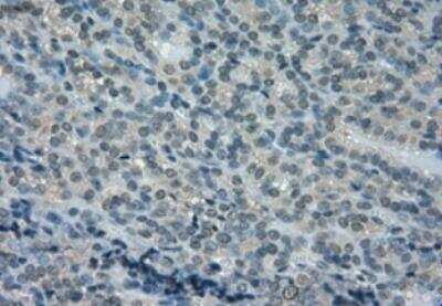 Immunohistochemistry-Paraffin: Dihydrofolate Reductase/DHFR Antibody (OTI6G7) [NBP1-47727]