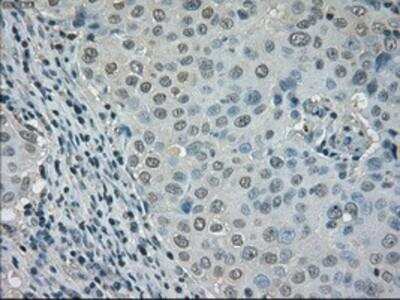 Immunohistochemistry-Paraffin: Dihydrofolate Reductase/DHFR Antibody (OTI6G7) [NBP1-47727]