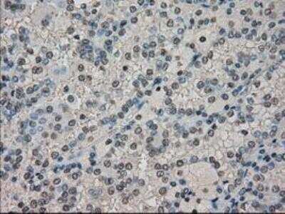 Immunohistochemistry-Paraffin: Dihydrofolate Reductase/DHFR Antibody (OTI6G7) [NBP1-47727]