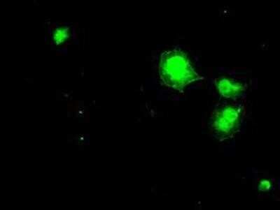 Immunocytochemistry/ Immunofluorescence: Dihydrofolate Reductase/DHFR Antibody (OTI6G7) - Azide and BSA Free [NBP2-70569]
