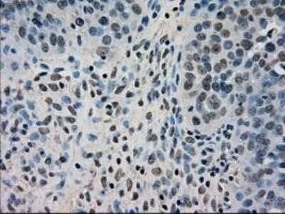 Immunohistochemistry: Dihydrofolate Reductase/DHFR Antibody (OTI6G7) - Azide and BSA Free [NBP2-70569]