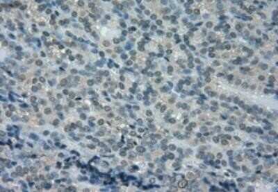 Immunohistochemistry: Dihydrofolate Reductase/DHFR Antibody (OTI6G7) - Azide and BSA Free [NBP2-70569]