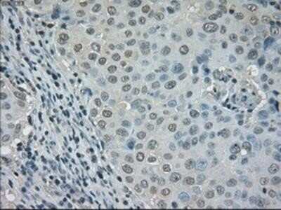 Immunohistochemistry: Dihydrofolate Reductase/DHFR Antibody (OTI6G7) - Azide and BSA Free [NBP2-70569]