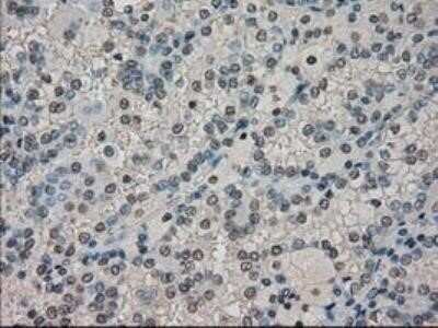 Immunohistochemistry: Dihydrofolate Reductase/DHFR Antibody (OTI6G7) - Azide and BSA Free [NBP2-70569]