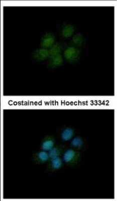 Immunocytochemistry/ Immunofluorescence: Dihydrofolate Reductase/DHFR Antibody [NBP2-16163]