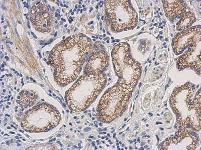 Immunohistochemistry-Paraffin: Dihydrofolate Reductase/DHFR Antibody [NBP2-16163]