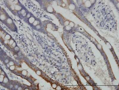 Immunohistochemistry-Paraffin: Dihydrolipoamide Dehydrogenase/DLD Antibody (1G11) [H00001738-M04]
