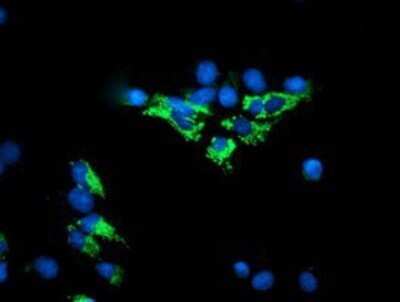 Immunocytochemistry/ Immunofluorescence: Dihydrolipoamide Dehydrogenase/DLD Antibody (OTI6D5) - Azide and BSA Free [NBP2-70574]