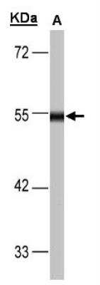 Western Blot: Dihydrolipoamide Dehydrogenase/DLD Antibody [NBP1-31302]