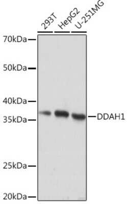 Western Blot: Dimethylarginine Dimethylaminohydrolase 1/DDAH1 Antibody (1Q5F6) [NBP3-16444]