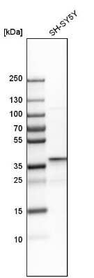 Western Blot: Dimethylarginine Dimethylaminohydrolase 1/DDAH1 Antibody [NBP1-85273]