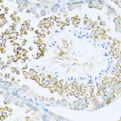 Immunohistochemistry-Paraffin: Dishevelled-1 Antibody - Azide and BSA Free [NBP2-92847]