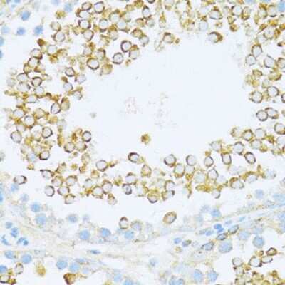Immunohistochemistry-Paraffin: Dishevelled-1 Antibody - Azide and BSA Free [NBP2-92847]
