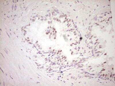 Immunohistochemistry-Paraffin: Dishevelled-2 Antibody (OTI2D11) [NBP2-46480]