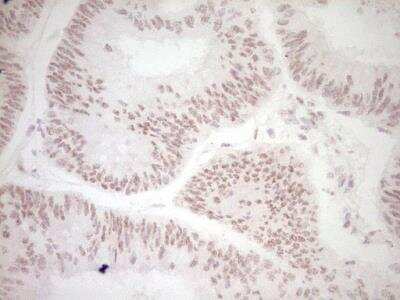 Immunohistochemistry-Paraffin: Dishevelled-2 Antibody (OTI2D11) [NBP2-46480]