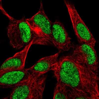 Immunocytochemistry/ Immunofluorescence: Dishevelled-2 Antibody [NBP2-56345]