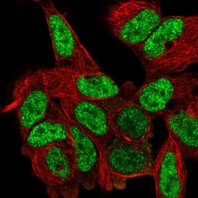 Immunocytochemistry/ Immunofluorescence: Dishevelled-2 Antibody [NBP2-58480]