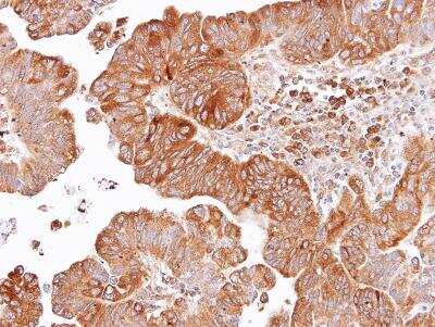 Immunohistochemistry-Paraffin: Dishevelled-2 Antibody [NBP1-32388]