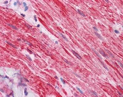 Immunohistochemistry-Paraffin: Dishevelled-2 Antibody [NBP1-58849]