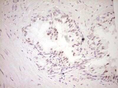 Immunohistochemistry: Dishevelled-2 Antibody (OTI2D11) - Azide and BSA Free [NBP2-70611]