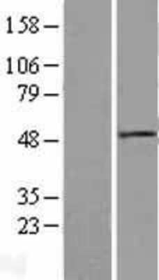 Western Blot: Dishevelled-1 Overexpression Lysate [NBL1-10062]