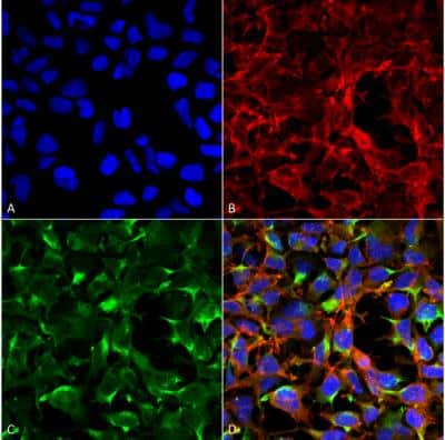 Immunocytochemistry/ Immunofluorescence: Dityrosine Antibody (7D4) [NBP2-59360]