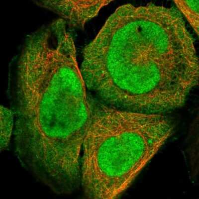 Immunocytochemistry/ Immunofluorescence: DjC9 Antibody [NBP1-87903]