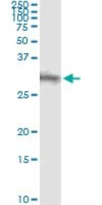 Immunoprecipitation: Dkk-1 Antibody (2A5) [H00022943-M11]