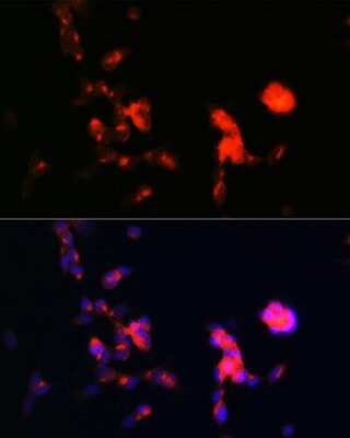 Immunocytochemistry/ Immunofluorescence: Dkk-3 Antibody (1R5E0) [NBP3-16293]