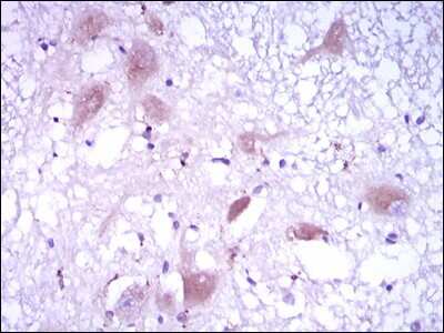 Immunohistochemistry-Paraffin: Dkk-3 Antibody (8A5C6) - BSA Free [NBP2-37430]