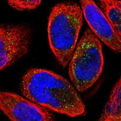 Immunocytochemistry/ Immunofluorescence: Dkk-3 Antibody [NBP1-80843]