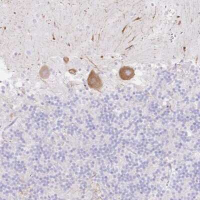 Immunohistochemistry: Dkk-4 Antibody [NBP2-47484]