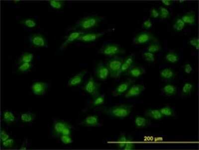 Immunocytochemistry/ Immunofluorescence: Dlx1 Antibody (2H3) [H00001745-M01]