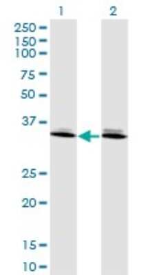 Western Blot: Dlx6 Antibody (2D7) [H00001750-M06]