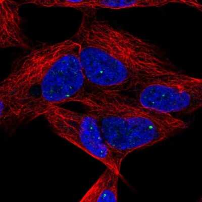 Immunocytochemistry/ Immunofluorescence: Dlx6 Antibody [NBP2-56915]