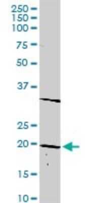 Western Blot: Dlx6 Antibody [H00001750-D01P]