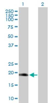 Western Blot: Dlx6 Antibody [H00001750-D01P]