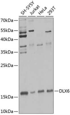 Western Blot: Dlx6 AntibodyBSA Free [NBP2-92511]