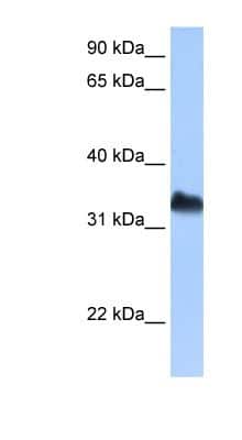 Western Blot: Dnd1 Antibody [NBP1-57258]