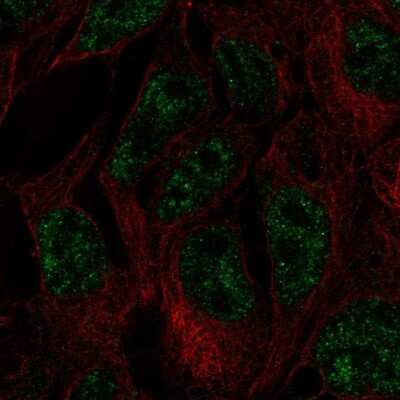Immunocytochemistry/ Immunofluorescence: Dnmt3L Antibody [NBP2-58155]