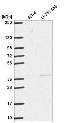 Western Blot: Dnmt3L Antibody [NBP2-58155]