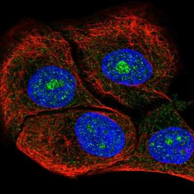 Immunocytochemistry/ Immunofluorescence: Dolichol Kinase Antibody [NBP2-68873]