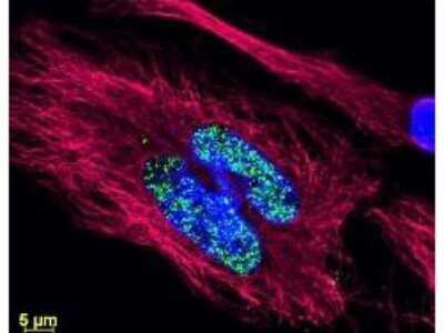 Immunocytochemistry/ Immunofluorescence: Donkey anti-Rabbit IgG (H+L) Secondary Antibody (Pre-adsorbed) [NBP1-72741]